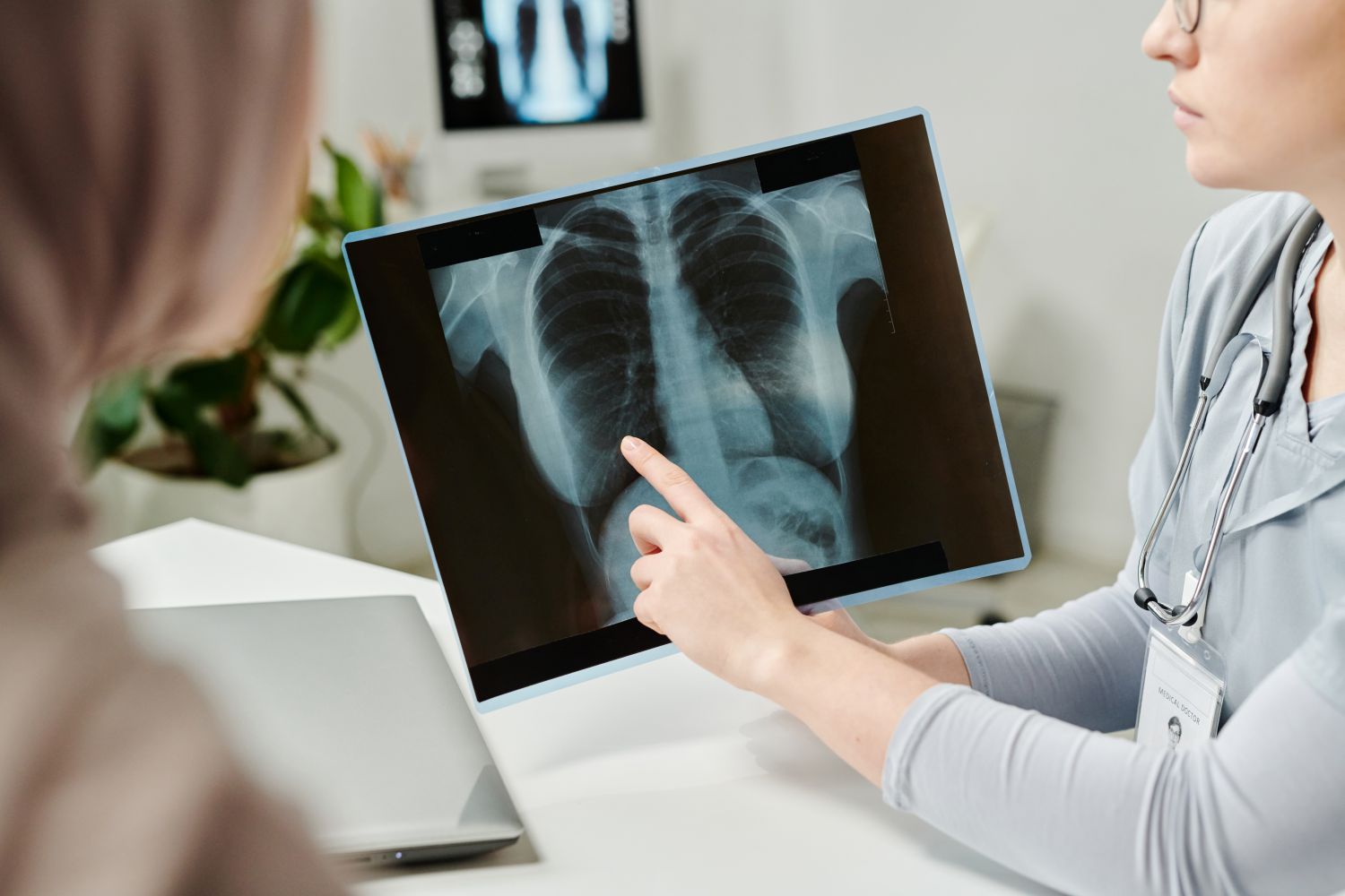 Pneumonia